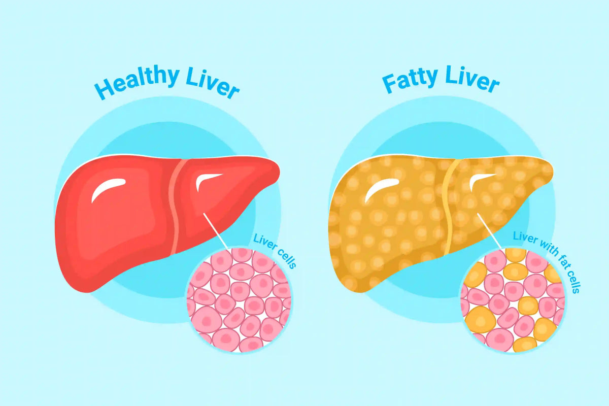 Understanding Liver Detox Supplements: Benefits, Ingredients, & Risk –  Genetic Nutrition
